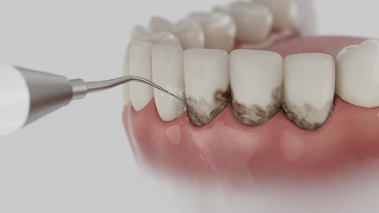 Trusted Tooth Extraction service in Seagoville, TX - Dentist Open Now